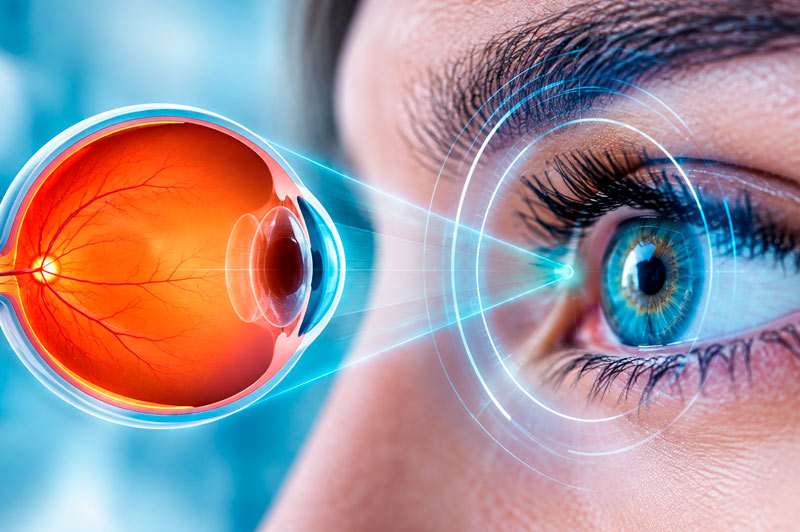 retinopatia